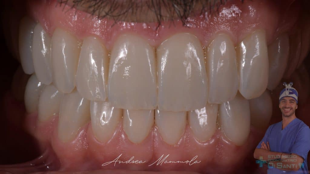 D9161EDC-64A1-4A96-8E45-4FFC56F3286F