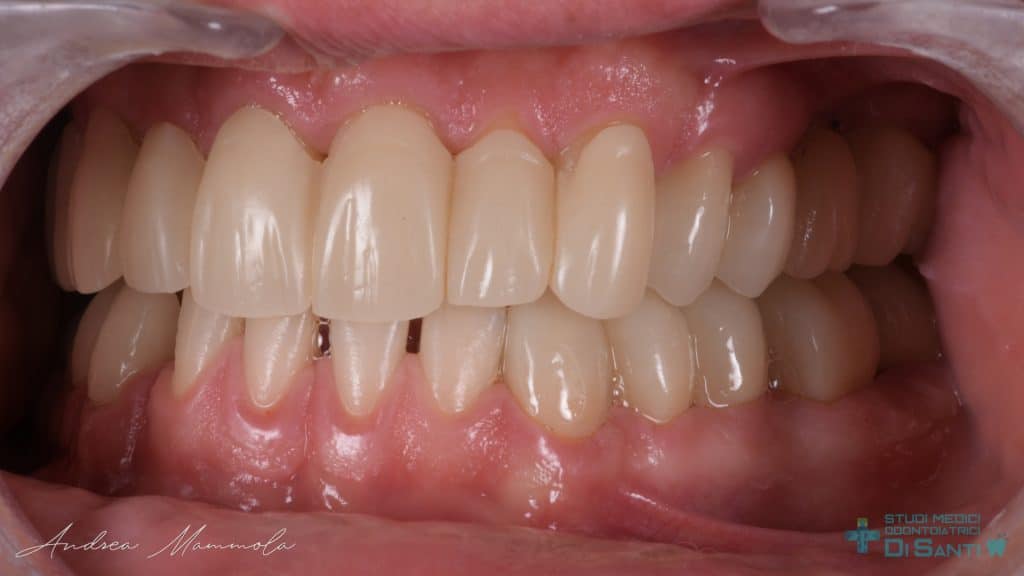 DF9F3906-8A68-4407-8411-A02FCBEE2FEA