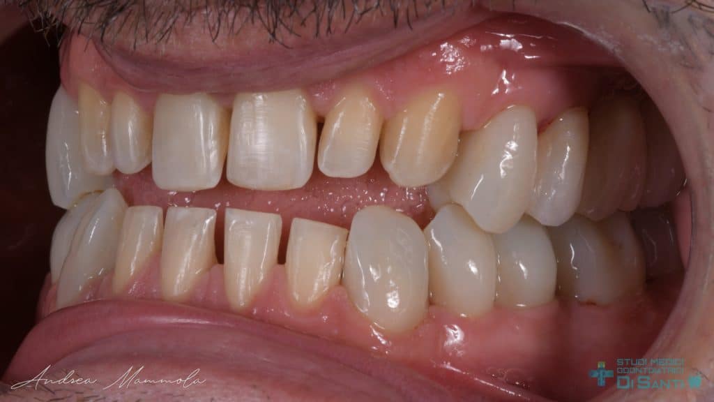 EA60262D-AAAE-434F-A3BF-C4010C037FC1