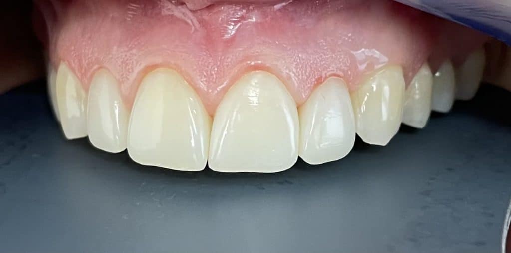 EBFBAB1E-FED5-437E-843D-E3E2E2FABBD5