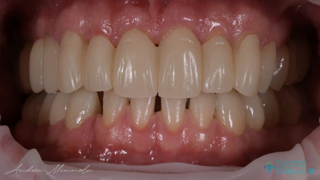 F676D2DD-5273-46CC-BE37-C6A0A285049A