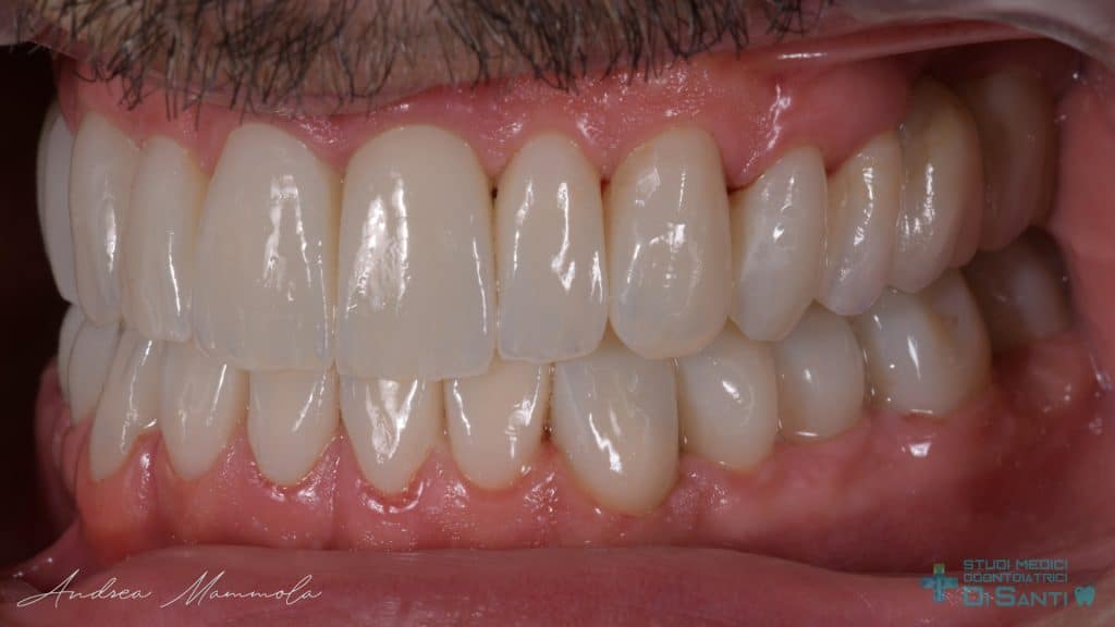 F931C83A-4B46-4FAC-9922-D9490C8C1AA8