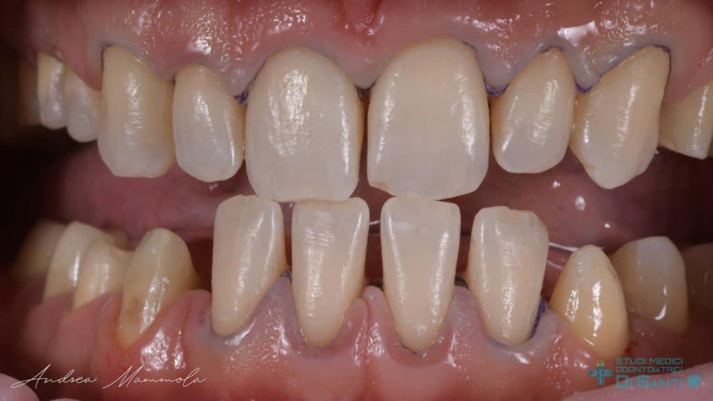 F93304D9-C03C-4FE4-8B72-D00F511A6114