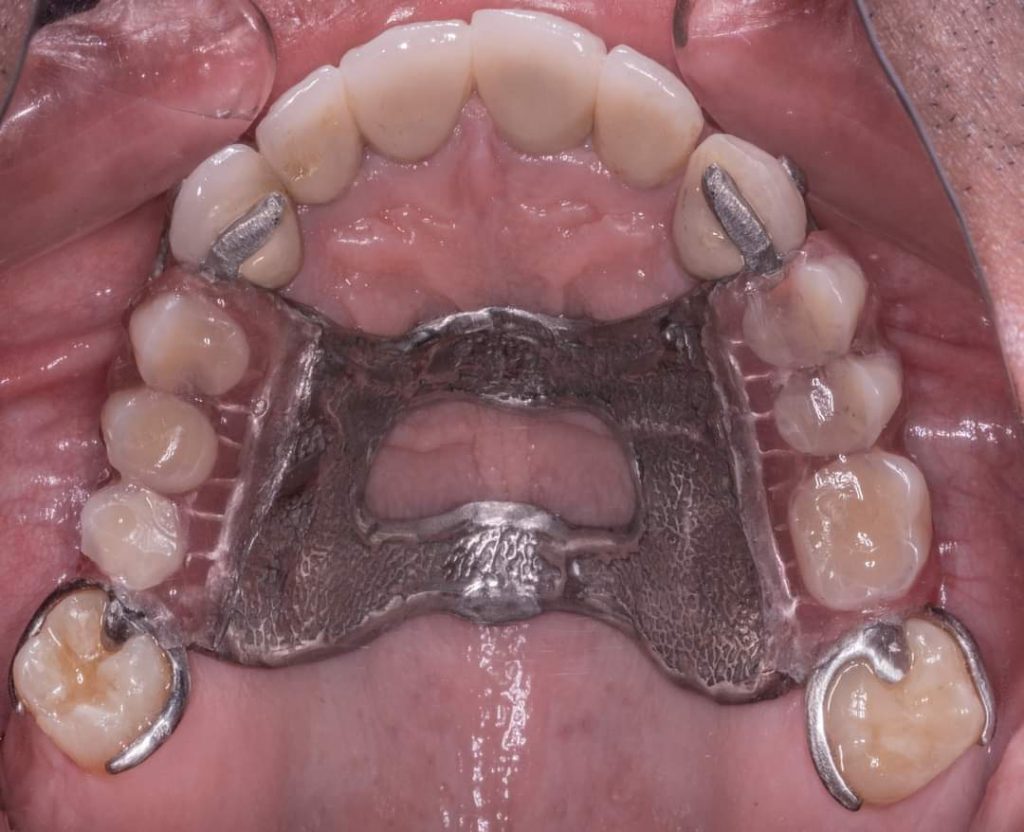 FB_IMG_1627386403077