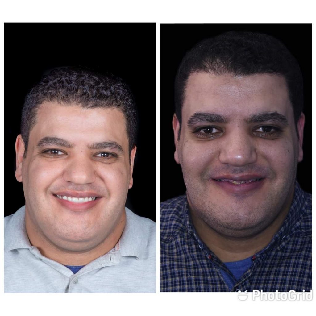 FB_IMG_1627386407013