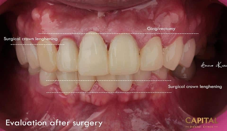 0E8852FA-402F-4DF1-BB4C-9FD88228BE8A