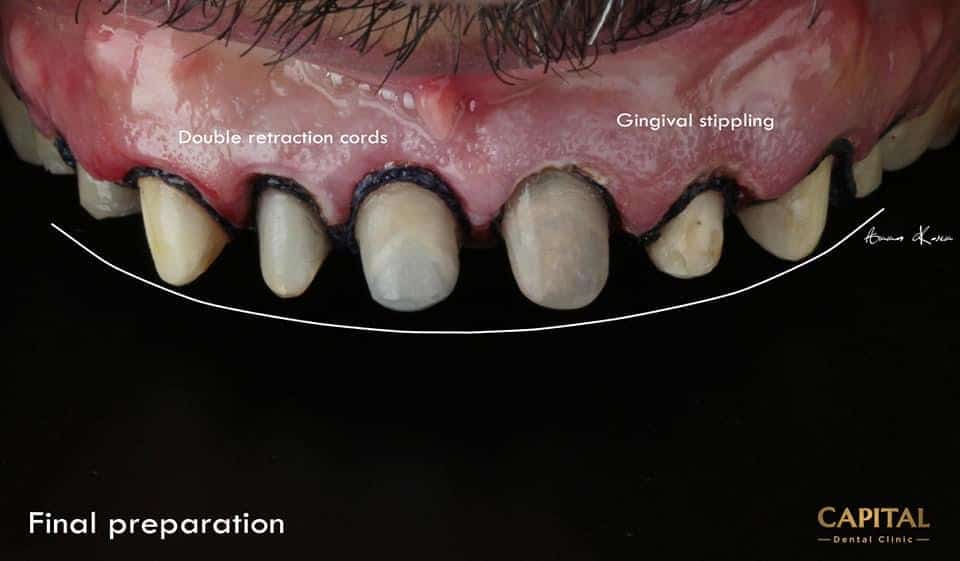 1390A6F1-D07B-487A-BFBA-BAB56A77AA27