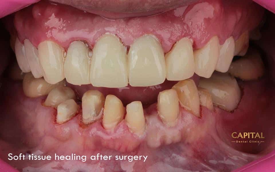 36142370-F235-46FA-8722-CB35699A7FF1