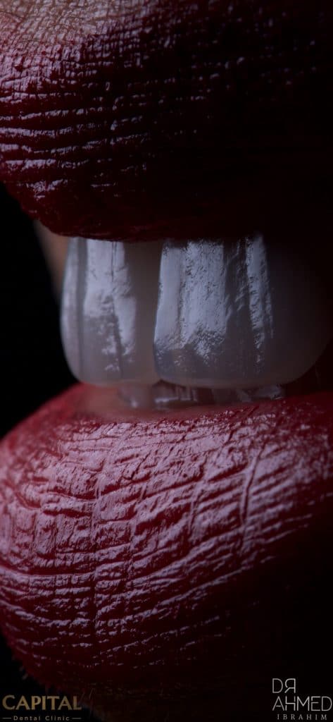 Processed with MOLDIV