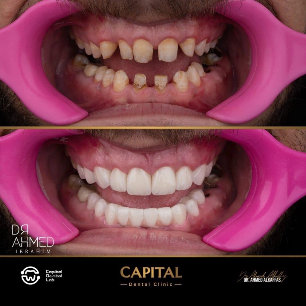 Processed with MOLDIV