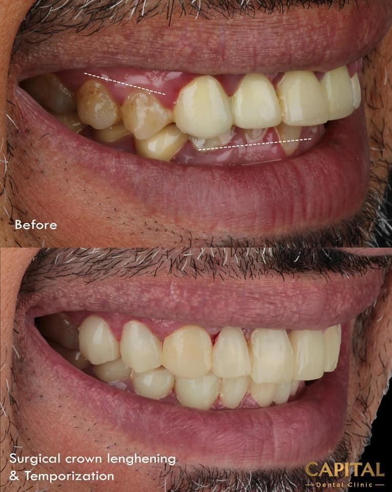 AAB3A33C-5CDA-4FB9-9D03-43D801B2354C