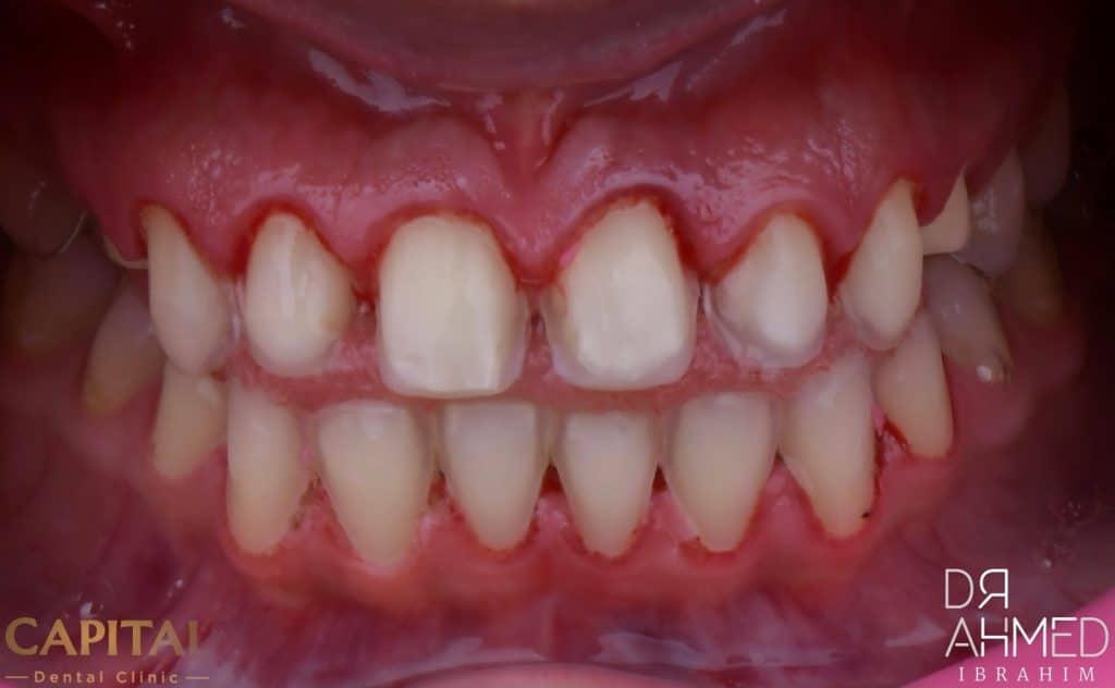 Adjusting preparation