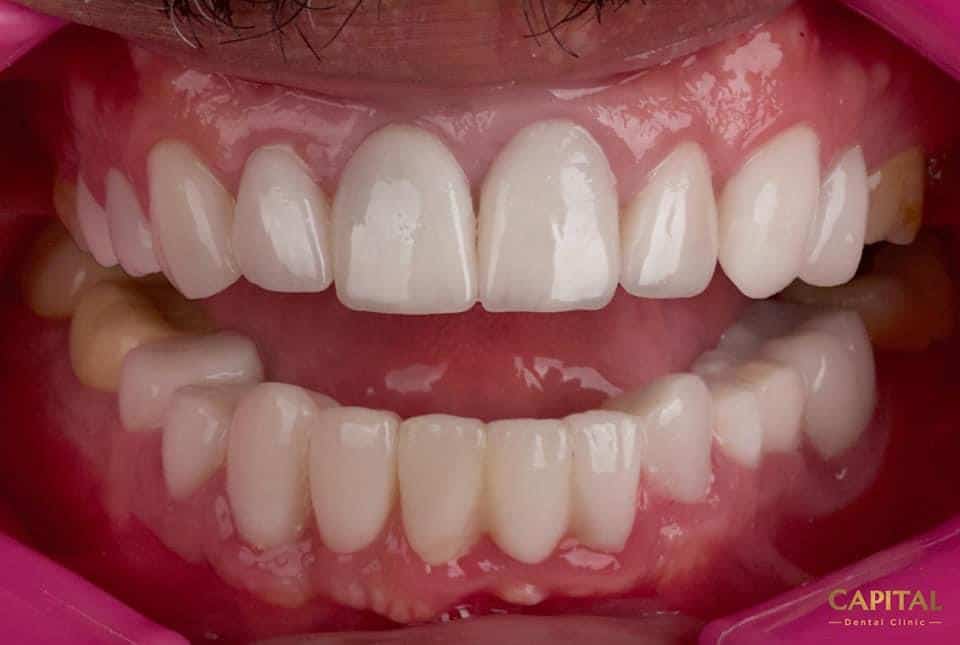 C5830B2B-3BA5-4CEB-A95C-E5A1420931D9