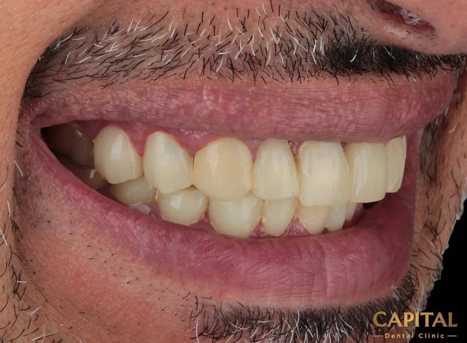 CB06B7D5-D17D-485E-9505-76CD5BC39DEC