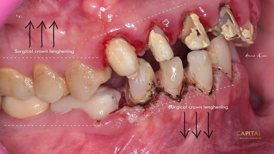 D2D74F19-CC80-43CF-900B-9D922318F5C1