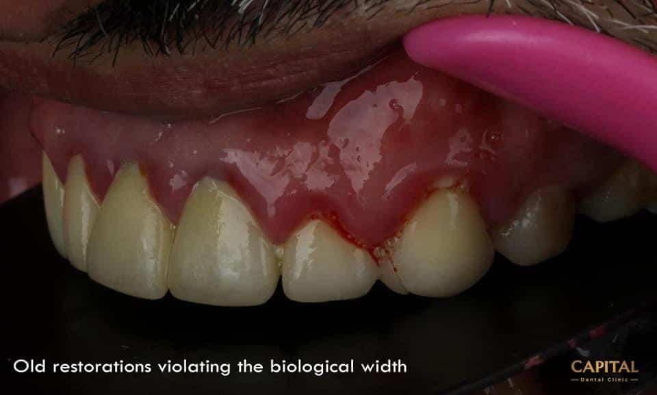 D95D316C-23EE-433C-92F2-1F6088F0C457