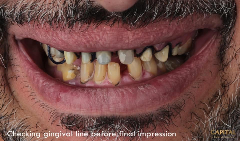 DC045EB0-A9C8-4C93-BBBA-59F3A6F1680A