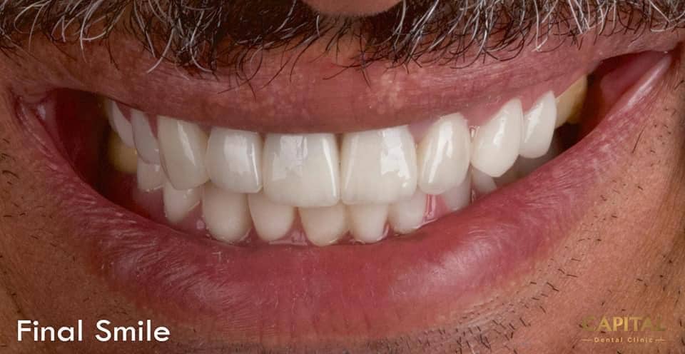 FDF1BB4A-EE58-4097-889A-8CBE214FD97F