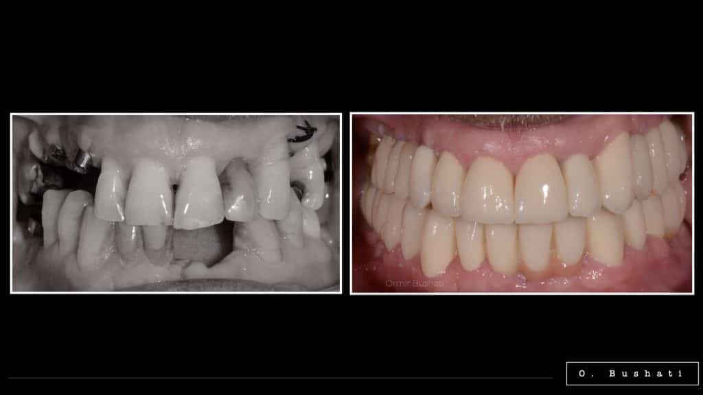 0983F093-FFD2-45D9-BEDB-3C86B6362918