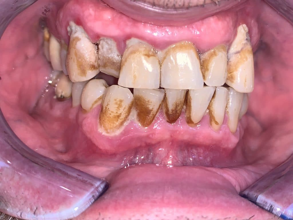 0DE4C5DE-FF28-47A8-B05D-0F0E7A4E8ABB