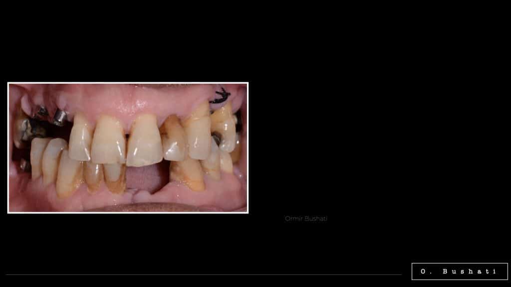 19D58D70-05DF-4E40-81B3-6BA4830CA599