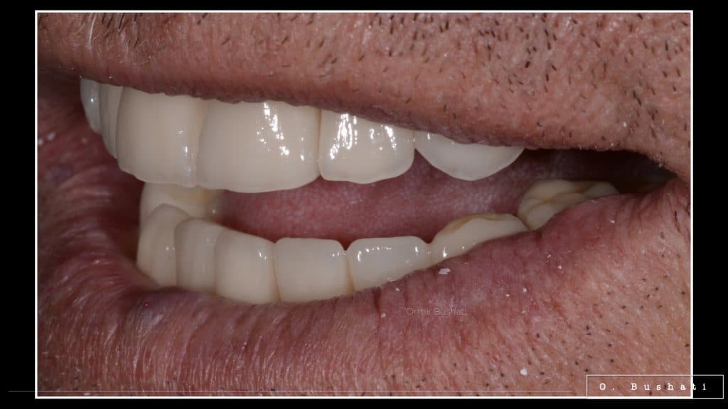 3F1DDA03-5CDF-4E3F-9A93-E1799813C75D