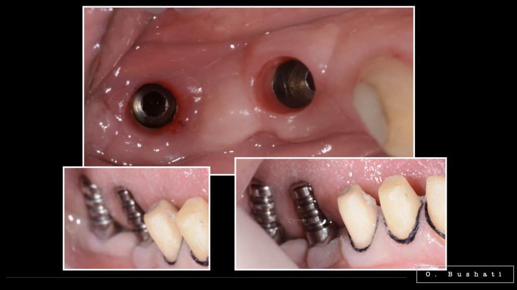 95DC6E0F-B8CB-447C-A17D-25EA92905916