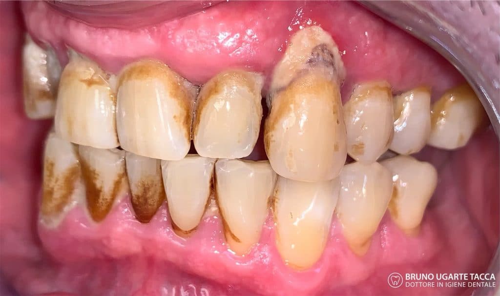 9A322410-D37A-4BBF-90F3-E262054693CB