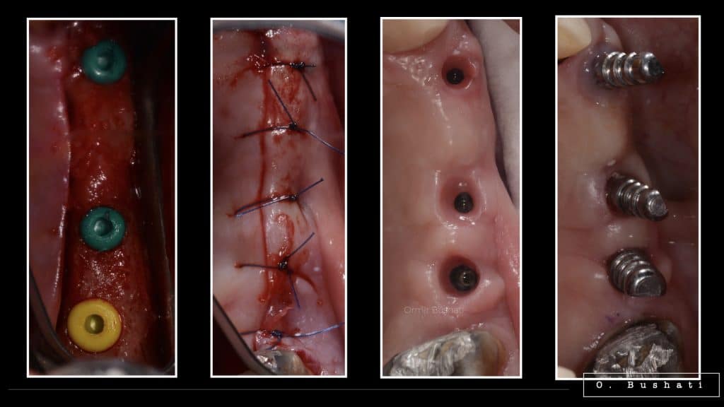 9FC9C842-7DE7-4BBF-8EB0-A06F0827E1D8