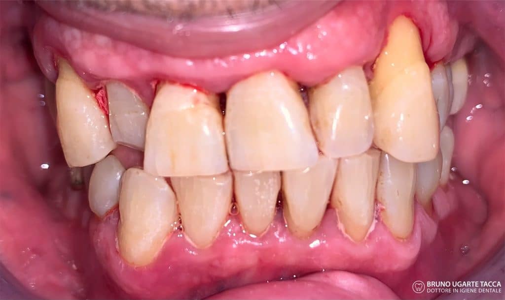 C14FB965-BFF6-4AF1-8546-47EDBF4EBBBB