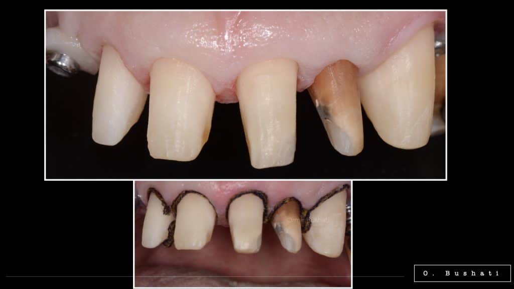 DBC14954-BF08-4C2B-A8F9-443DE6CC348F