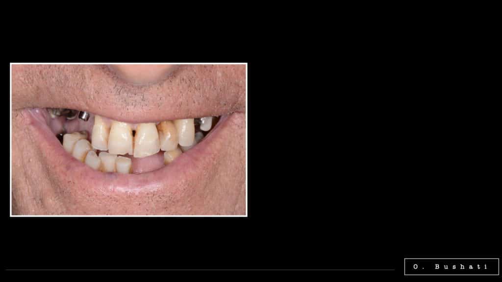 E753AC30-8DFE-4783-9319-6F455D6FBE46