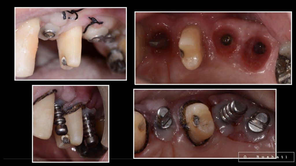 F252F8A9-3ACC-4B9D-93D2-C9077F6CB6AA