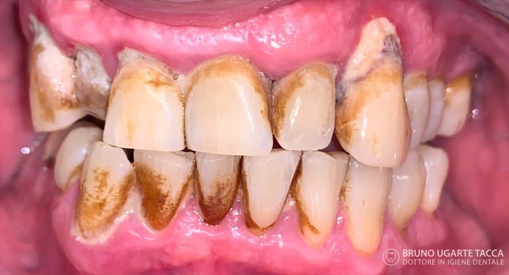 F61C6AD7-9681-42C4-B7B7-F1BE166BCDE8