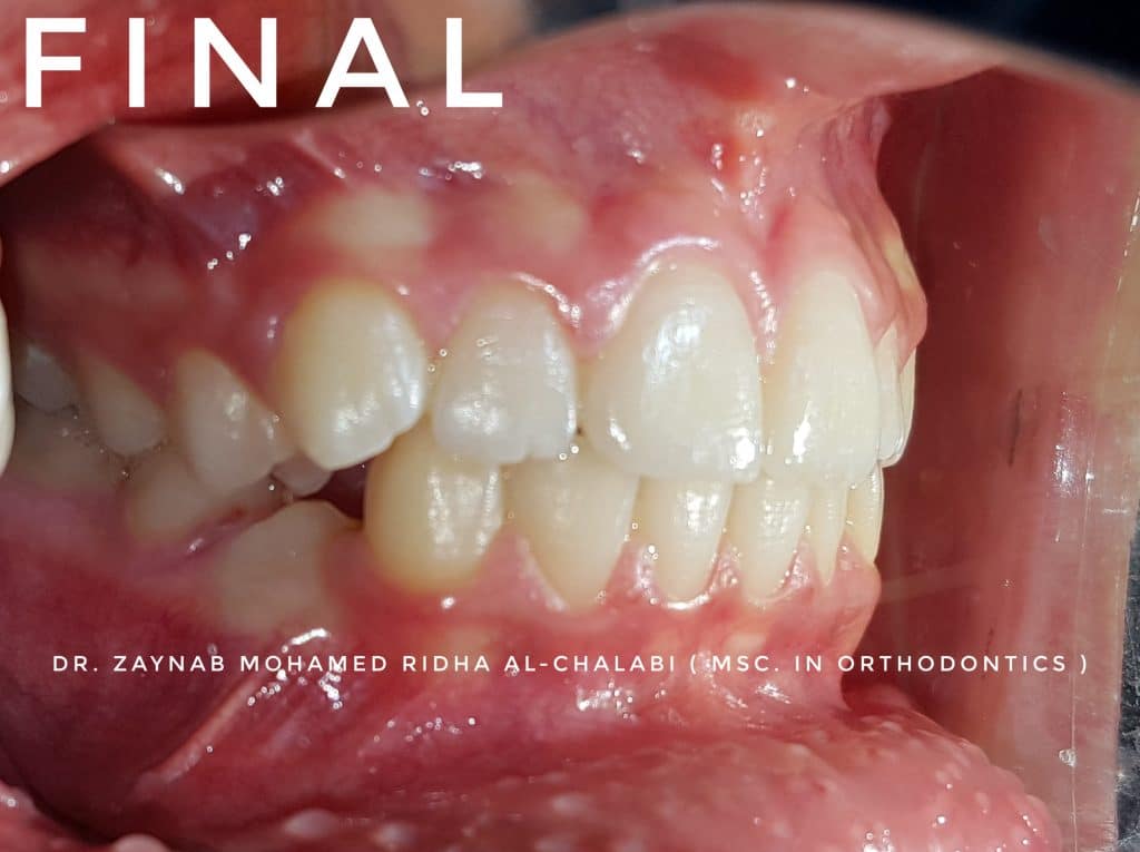 inbound1208843661916508381