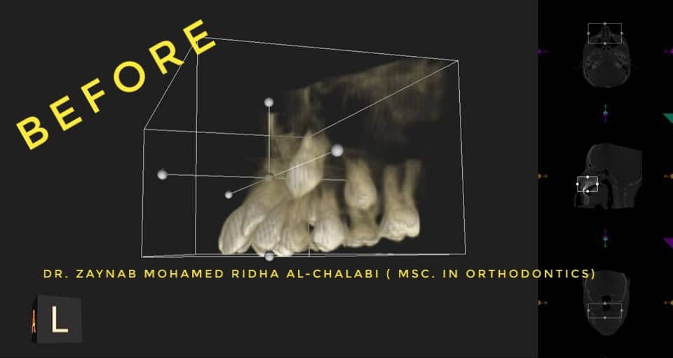 inbound3240070488888548432