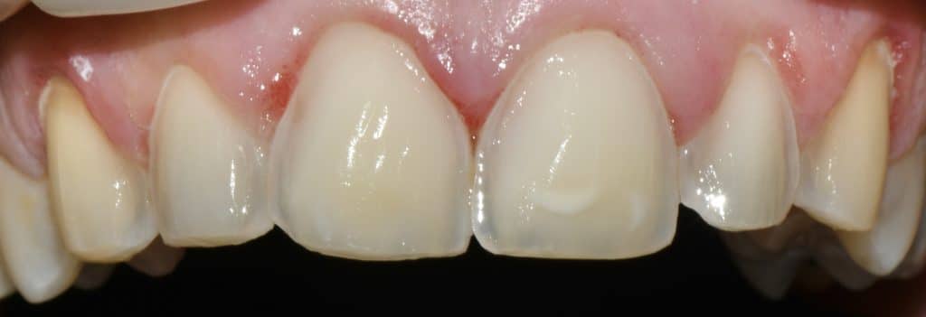 032D22FB-9B2F-4D30-A1C6-A08E4E674011