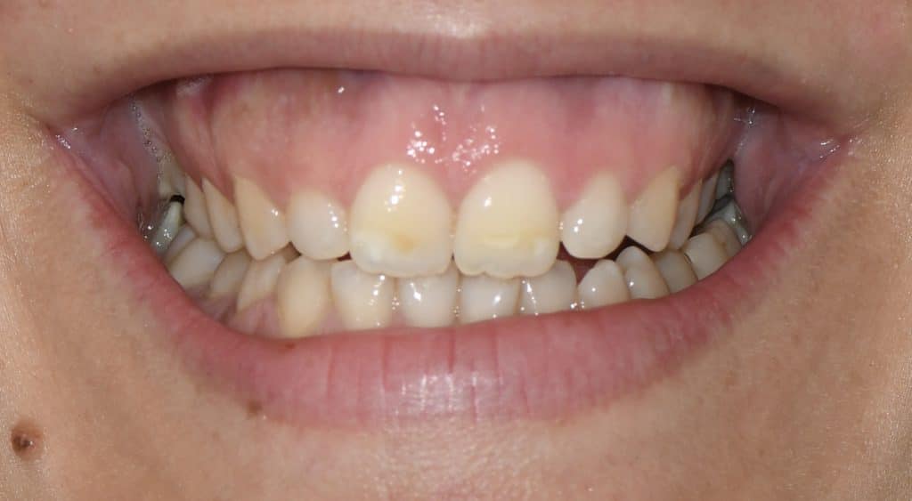 21A47C5E-A3B3-4212-B78B-8551480F5BDA