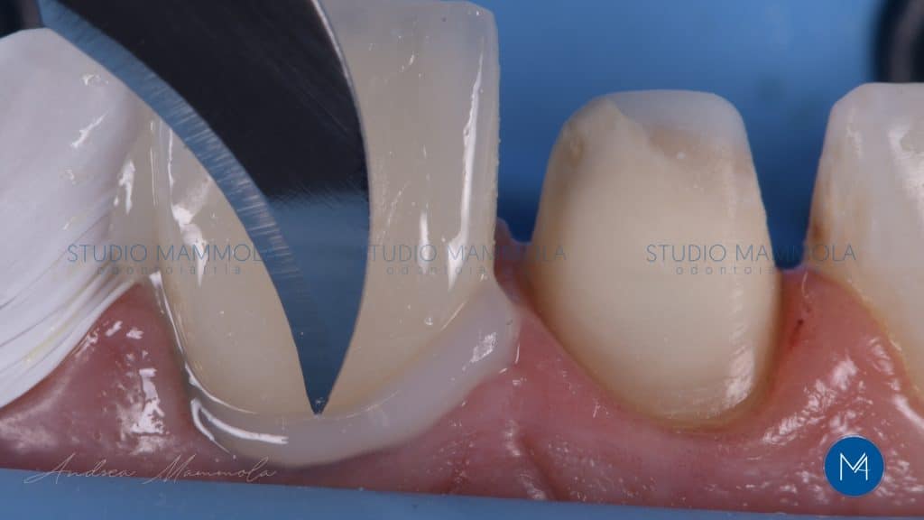 422913D9-8717-4E71-B2DD-9599F04DF95C