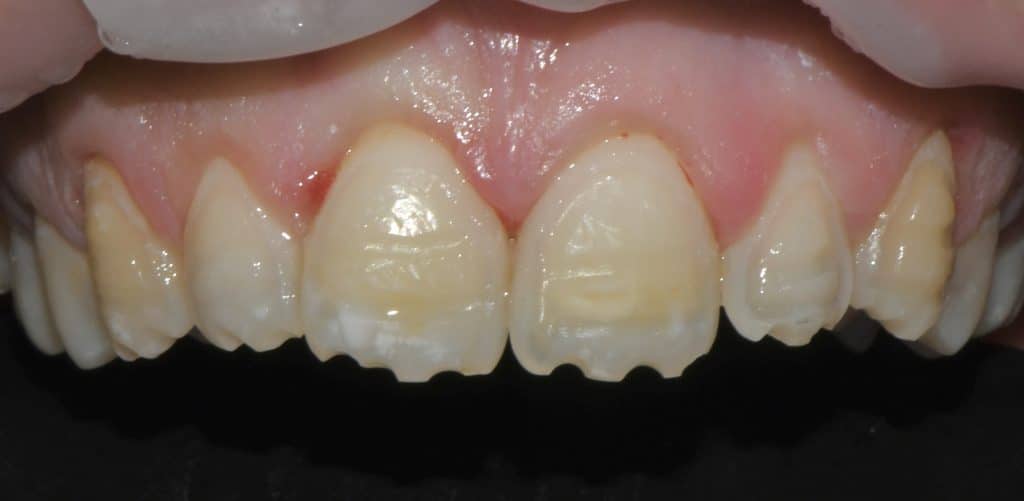 56F4D16B-72AA-4EEE-8F71-AE9051768EC9