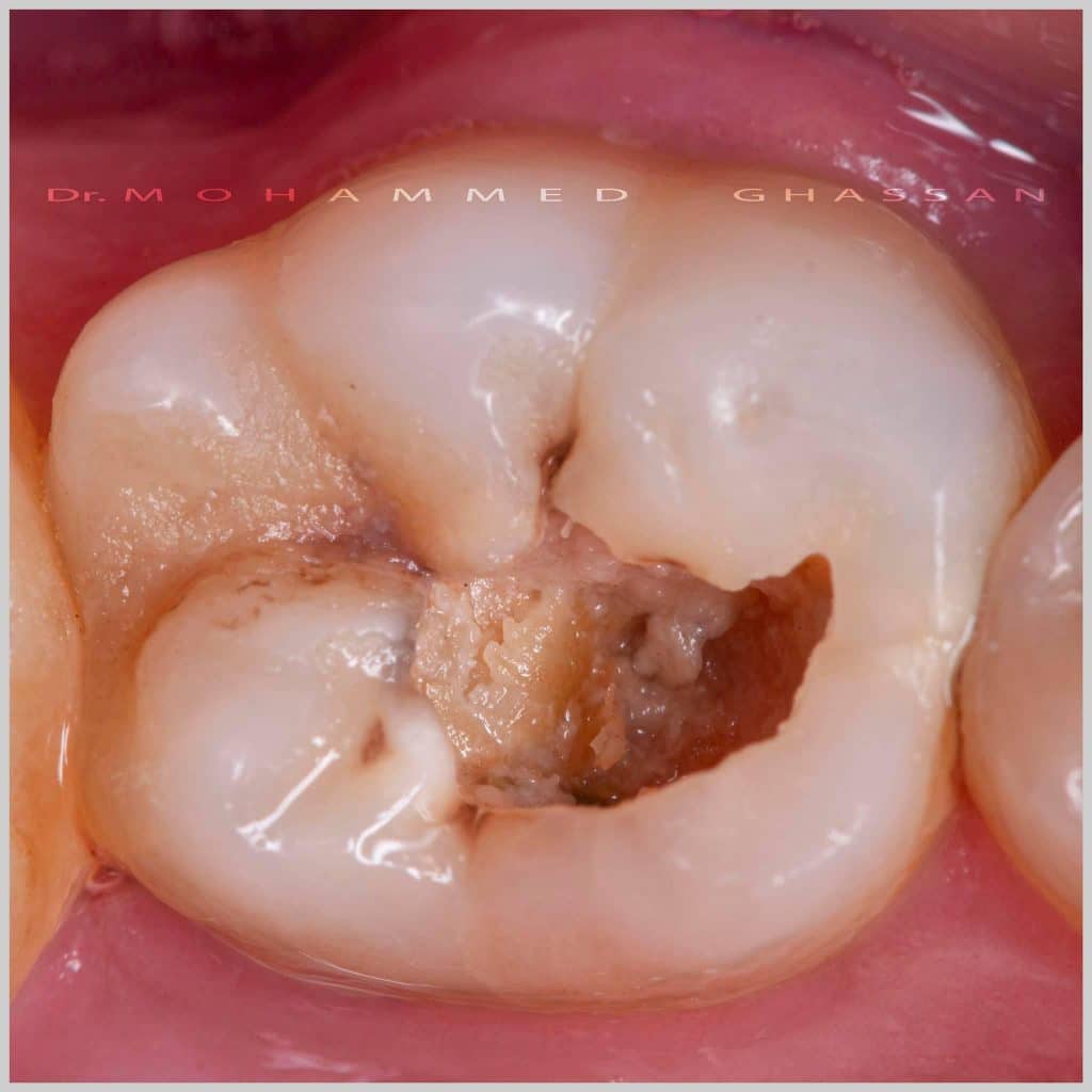 5EB2B722-ED63-4515-980F-C762E3C038E7