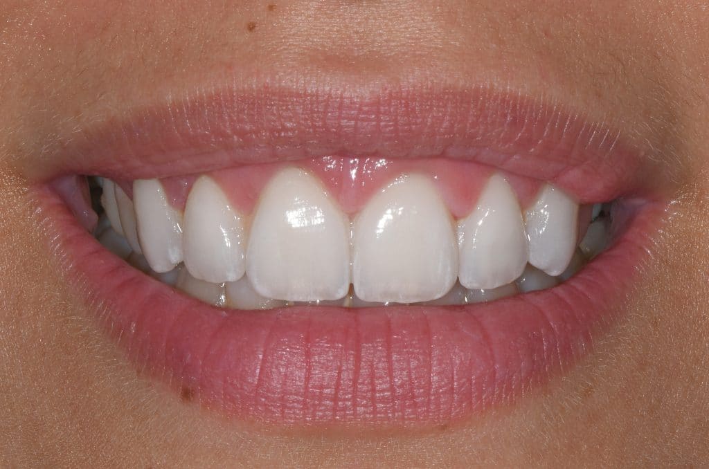 7923B5D5-E434-4BBF-9FF3-68F8B7EF44E8