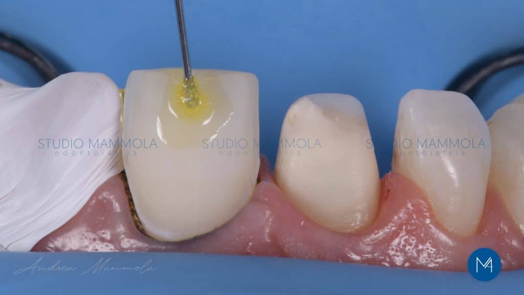 825CBD02-68B0-4D3E-92B6-96AEA235B837