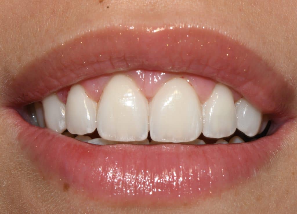 87B872B8-12A6-481C-B536-687A97029596