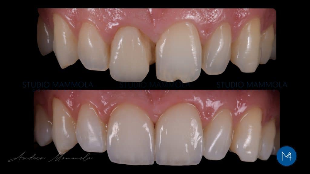 9762035A-76A5-44CE-B94F-EC5BF7421C3C