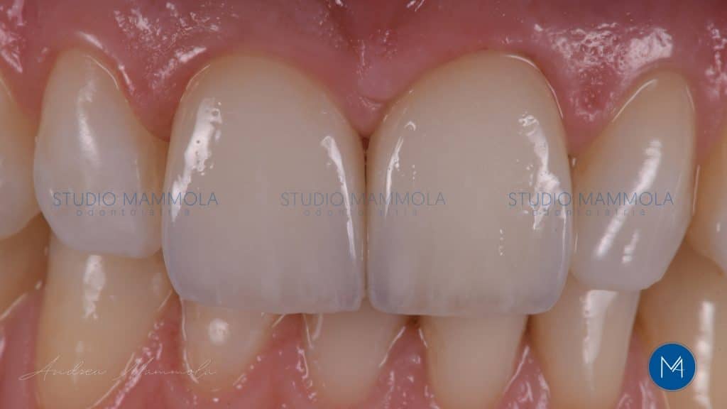 9F3566E5-E5B9-42B4-9F39-6BFB8444571E