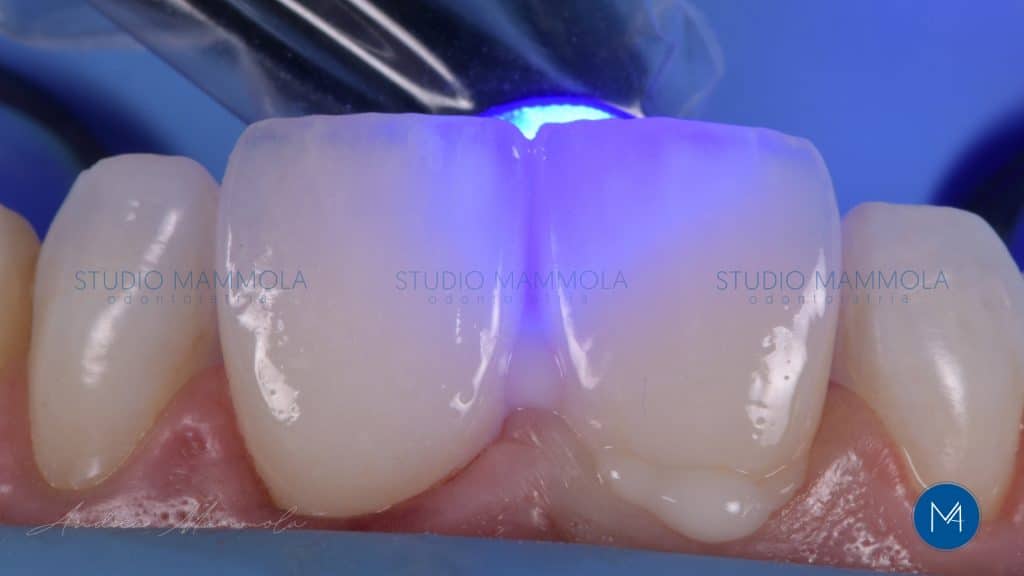 ACE2A2D5-2AA6-4850-9E9D-C4BF28FA3160