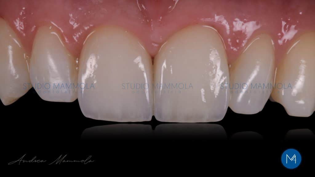 B0D1FF65-E9A4-4FE5-9BDF-586413AD109D