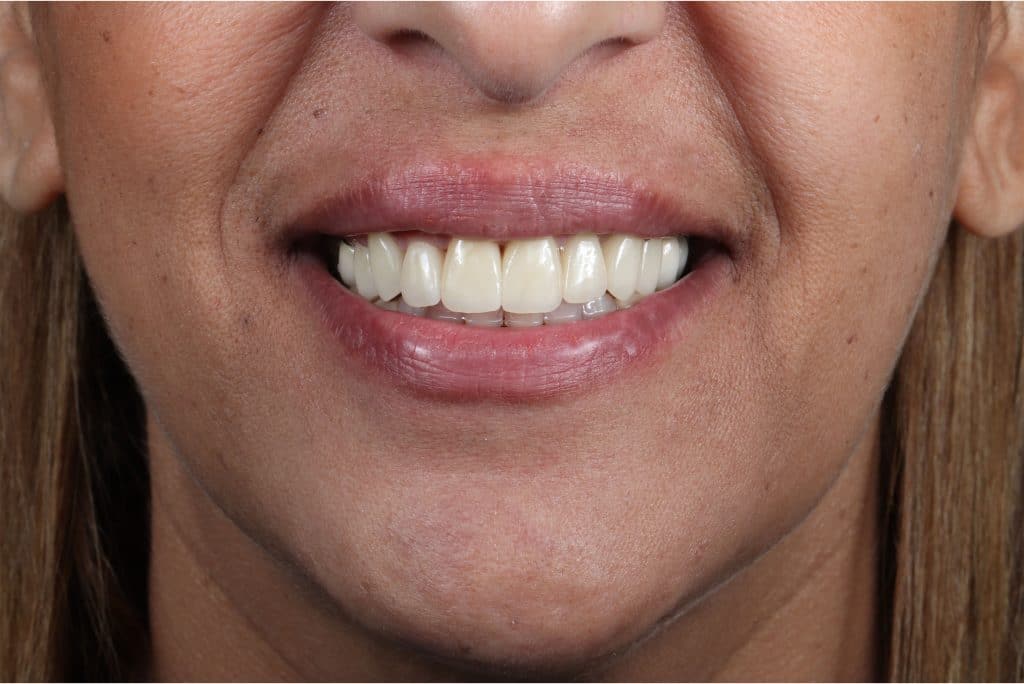 B447B685-10B7-4CEA-8165-036F86B28887