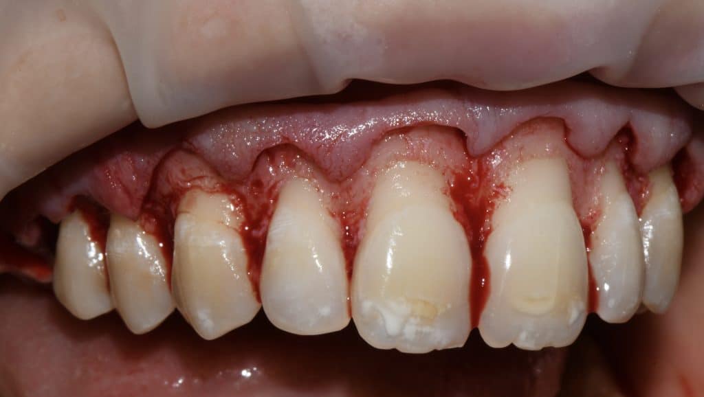 B9FC1ABE-D81B-4D6E-834E-E7A8EE1524D7